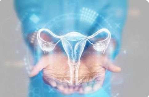 سندروم تخمدان پلی‌کیستیک (PCOS)؛ علل، علائم و روش‌های درمانی